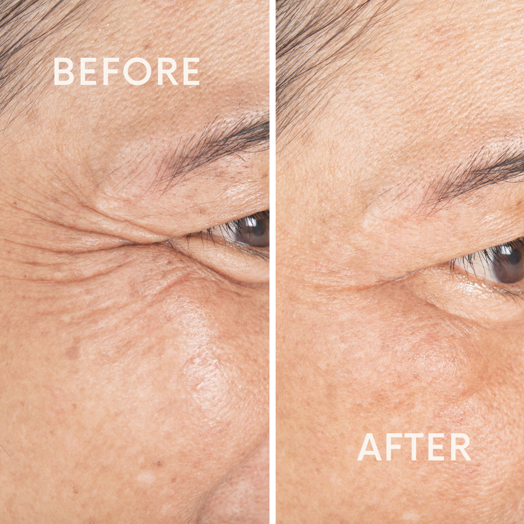 Protein Lift Serum - The Vegan Shop (Bestseller)